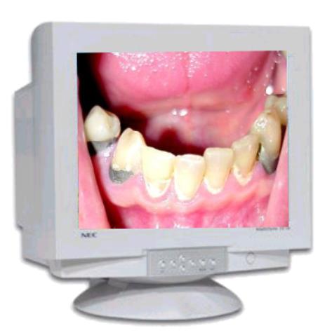 Image Host Server Experiencing Technical Difficulties. Click To See Back Up Image.