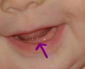 Enlarge photo 75