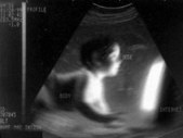 2007-9-19  New Born Baby