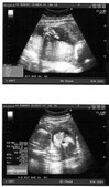 Kailia --One month at a time!