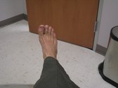 Toe