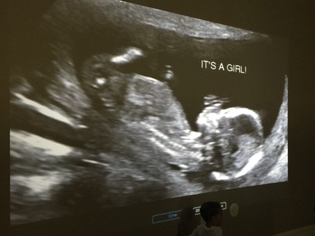 Baby Braasch