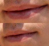Enlarge photo 252